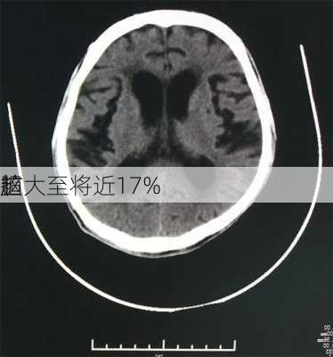 超
脑
扩大至将近17%