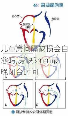 儿童房间隔缺损会自愈吗,房缺3mm最晚闭合时间